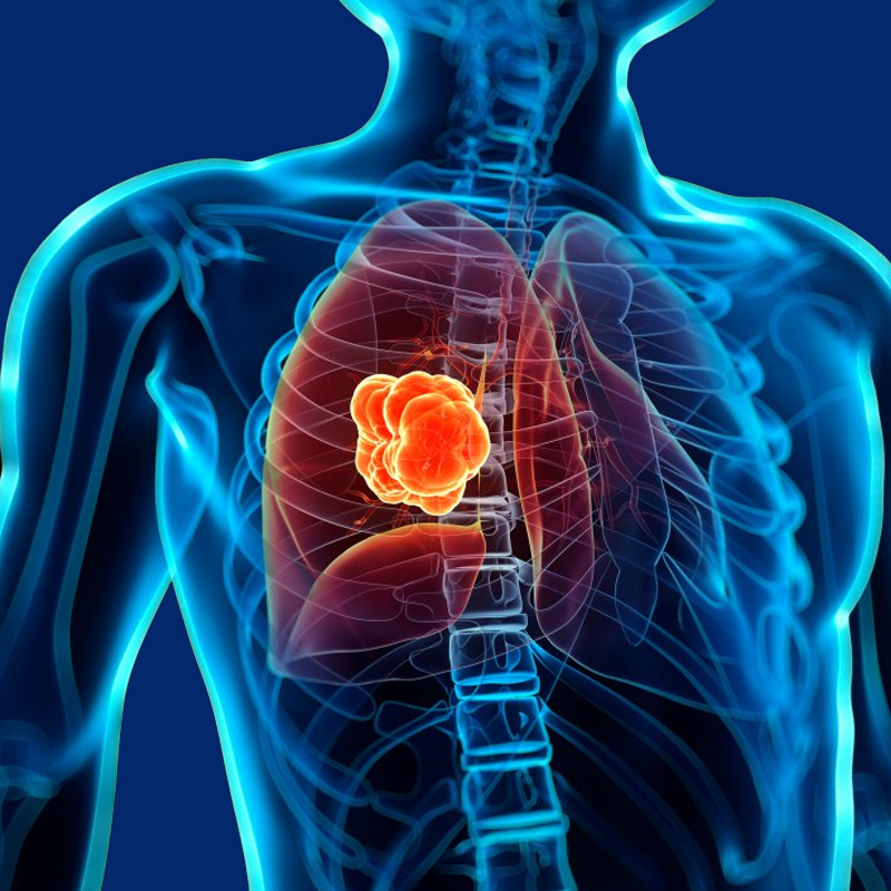 Nuclear Medicine Therapy & Theranostics