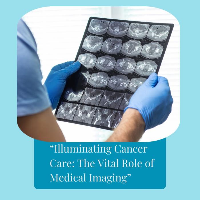 Medical imaging, Cancer diagnosis, Cancer treatment, PET scan, Radiology, Oncology, Nuclear medicine, Positron Emission Tomography (PET), Single-Photon Emission Computed Tomography (SPECT), Gamma camera, DOTATATE scan, DOTANOC scan, Radioisotopes, Radiotracers, Theranostics, Precision oncology, Hybrid imaging, Improved sensitivity & resolution, Faster scanning, Siemens Healthineers, Biograph Vision, Prostate cancer diagnosis, Neuroendocrine tumors, Treatment monitoring, Early cancer detection