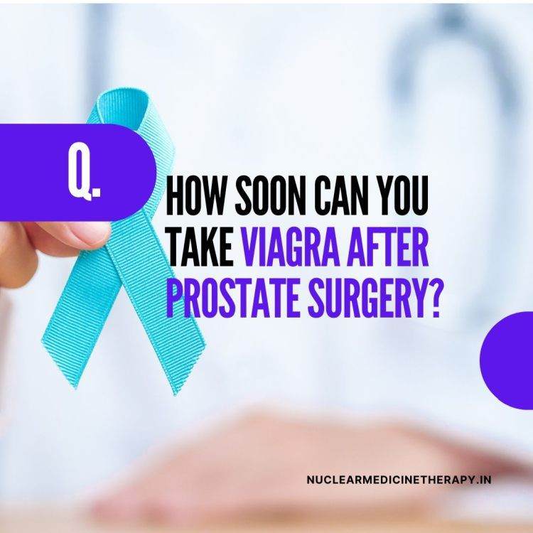 How Soon Can You take Viagra after Prostate Surgery