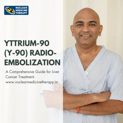 Yttrium-90 (Y-90) Radioembolization: A Comprehensive Guide for Liver Cancer Treatment