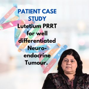 Patient Case Study - Results of Lutetium 177 PSMA Therapy ( Pluvicto ) in Metastatic Prostate Adenocarcinoma